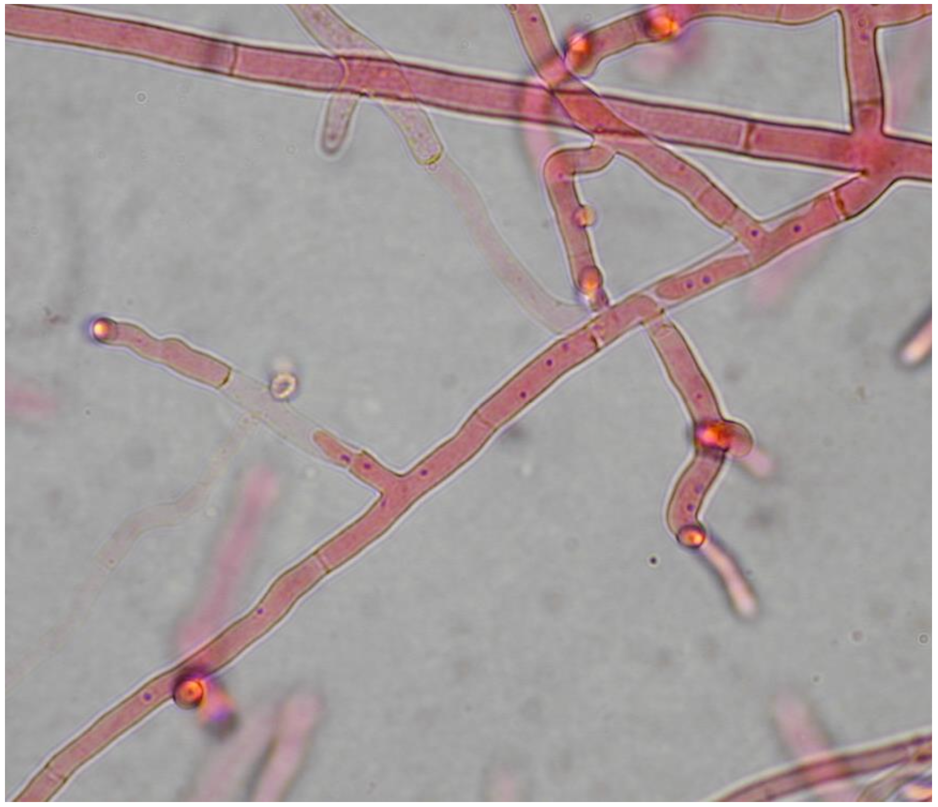 Rhizoctonia and Ceratobasidium comparative genomics